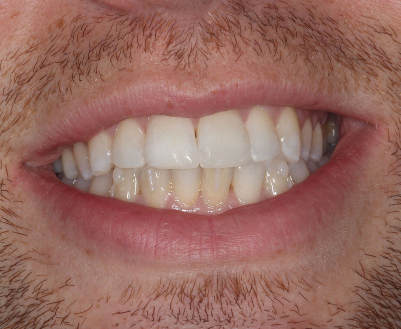 After